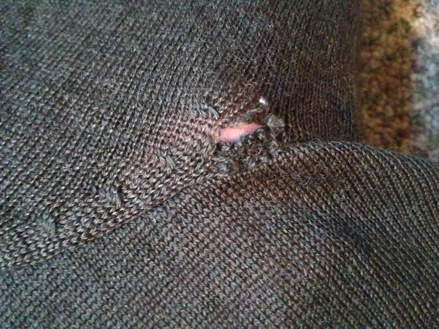 hole in brown sweater, skin visible through hole