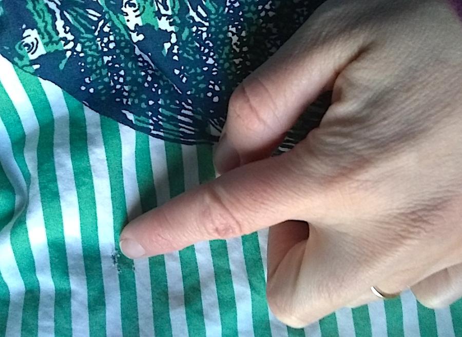 closeup of fabric of green and white fish print bathrobe: hand pointing out small hole in the fabric 